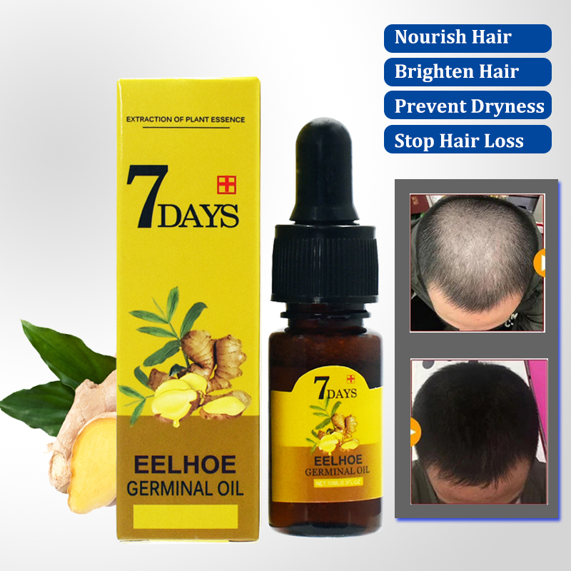 Hair Care Serum - Okeny's-Esencia de crecimiento del cabello para