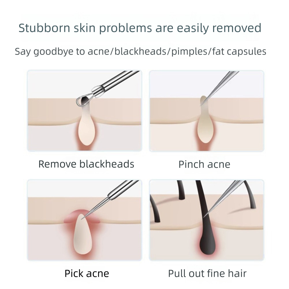 Pinzas para el pelo encarnado, - Hair Care Clinic reseña y precio