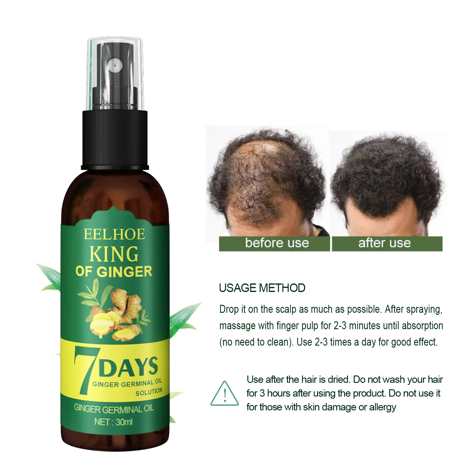 EELHOE Spray para el crecimien - Hair Care Serum reseña y precio