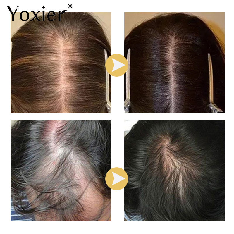 Suero de crecimiento intensivo - Hair Care Serum reseña y precio